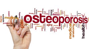 Osteoporosi: rischio ridotto per chi vive vicino ad aree verdi